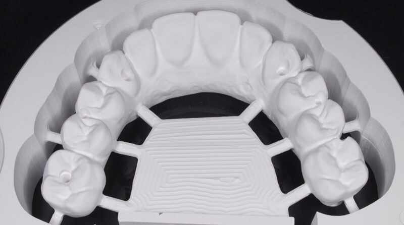 циркониевый протез PRETTAU выточенный по 3D модели на CAD CAM фрезере Zirkonzahn